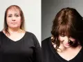 Prima e dopo: capelli diradati davanti, ora più folti e con un taglio che valorizza chi ha pochi capelli.