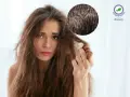 Capelli spenti e cuoio capelluto irritato? Scopri i rimedi naturali con acido lattico e bicarbonato per una chioma sana e luminosa.