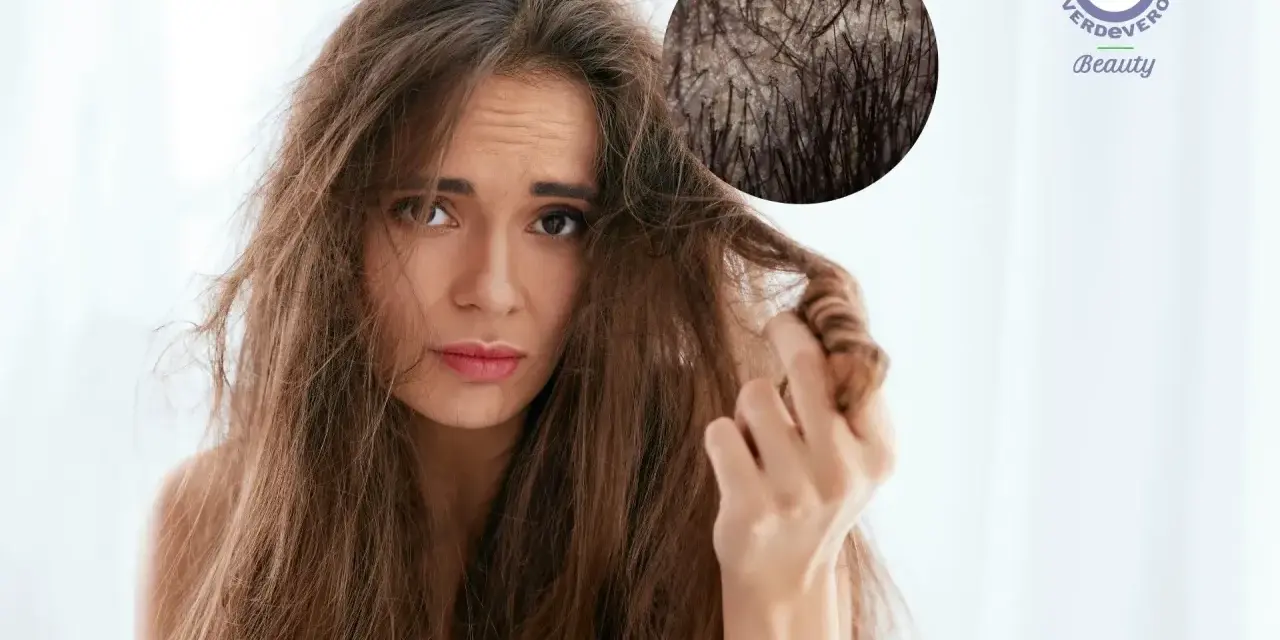 Capelli spenti e cuoio capelluto irritato? Scopri i rimedi naturali con acido lattico e bicarbonato per una chioma sana e luminosa.