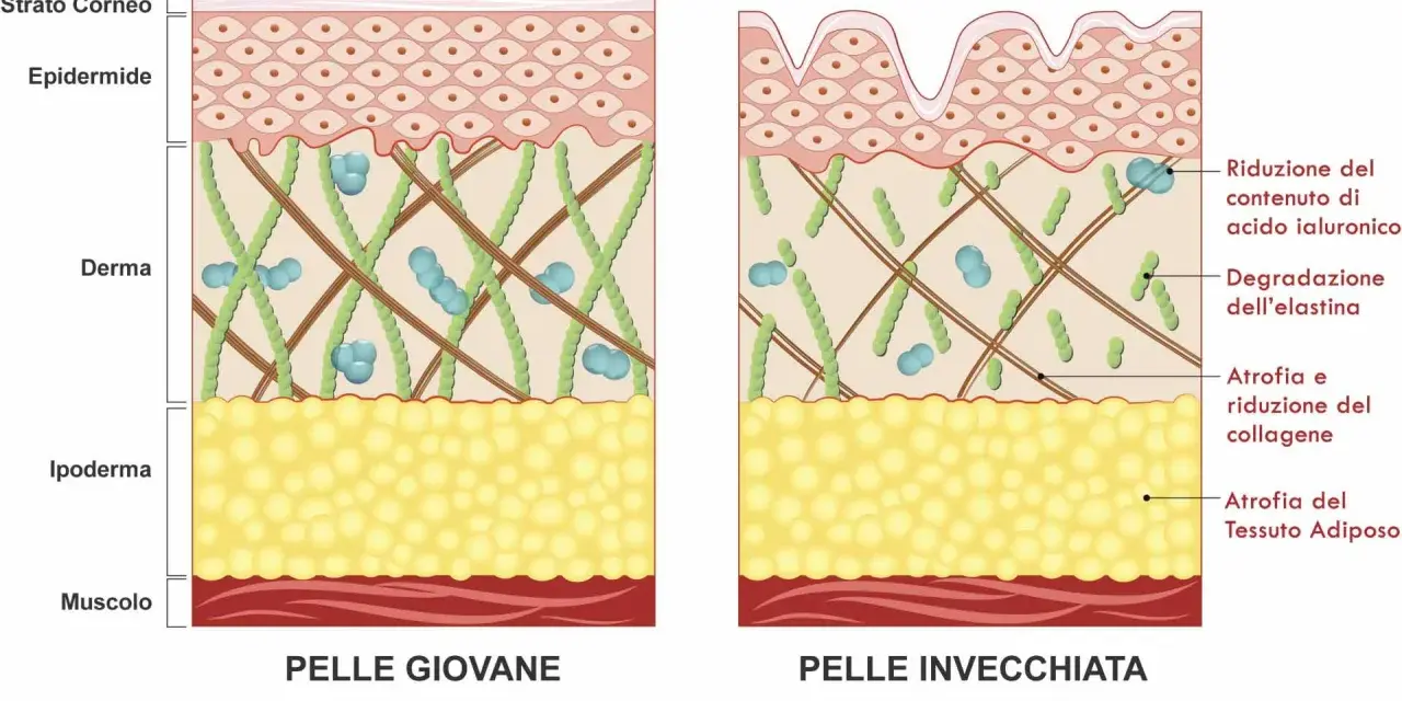 Confronto pelle giovane e invecchiata: la degradazione dell'elastina e del collagene causa rughe.