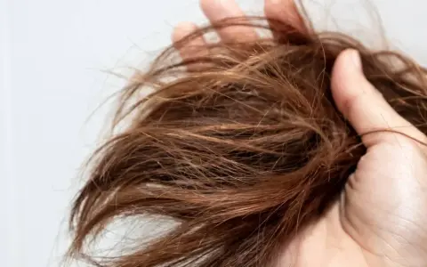 Mano che tiene ciocche di capelli castani, secchi e sfibrati, con punte visibilmente danneggiate, quasi capelli bruciati.