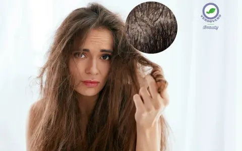 Capelli spenti e cuoio capelluto irritato? Scopri i rimedi naturali con acido lattico e bicarbonato per una chioma sana e luminosa.