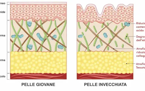 Confronto pelle giovane e invecchiata: la degradazione dell'elastina e del collagene causa rughe.