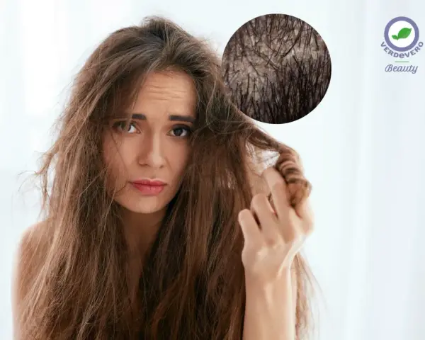 Capelli spenti e cuoio capelluto irritato? Scopri i rimedi naturali con acido lattico e bicarbonato per una chioma sana e luminosa.