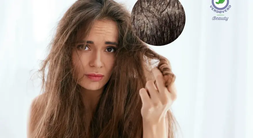 Capelli spenti e cuoio capelluto irritato? Scopri i rimedi naturali con acido lattico e bicarbonato per una chioma sana e luminosa.