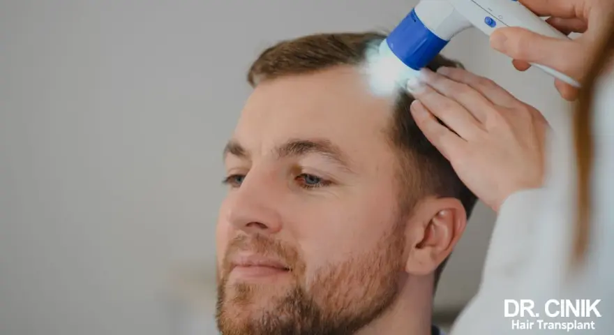 Esame del cuoio capelluto per capire come riattivare i follicoli dei capelli naturalmente.