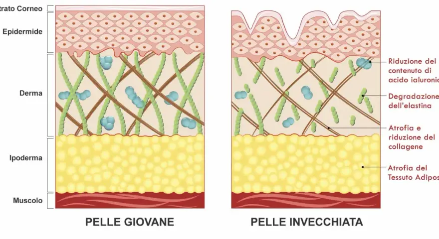 Confronto pelle giovane e invecchiata: la degradazione dell'elastina e del collagene causa rughe.