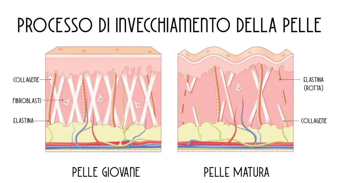 Confronto pelle giovane e matura: la pelle giovane ha elastina integra, mentre quella matura mostra elastina rotta, evidenziando cos'&egrave; l'elastina e il suo ruolo nell'invecchiamento.
